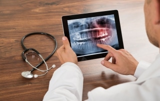 Slikanje zob - zobozdravnik pregleduje RTG sliko