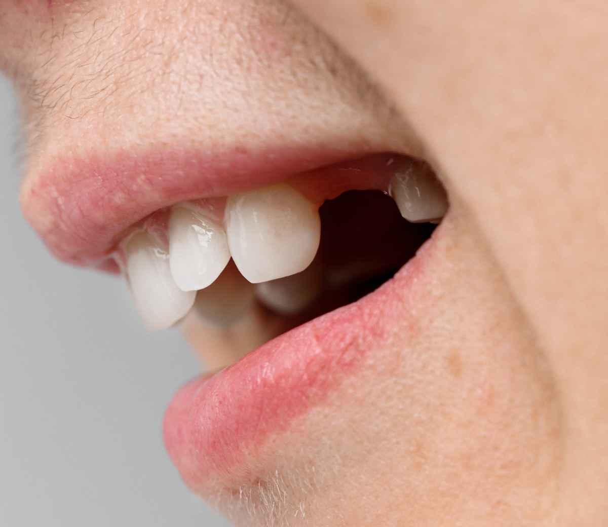 Implantati so dolgoročna rešitev.