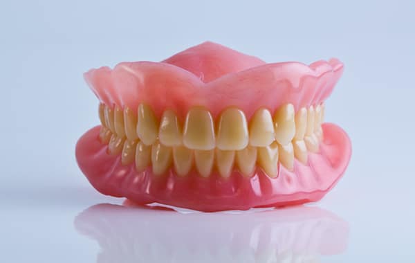 Zobna protetika - Zobne luske